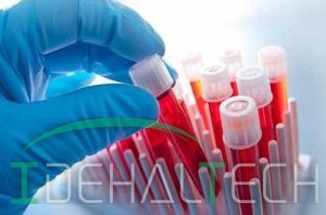 MVC در آزمایش خون چیست؟